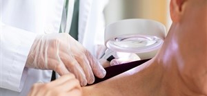 Understanding Warts, Causes, and Wart Removal Treatment